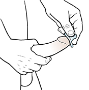 Man putting condom over tip of erect penis.